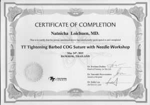 24-03-2015 TT Tightening Barbed COG Suture with Needle Workshop 24-03-2015 TT Tightening Barbed COG Suture with Needle Workshop